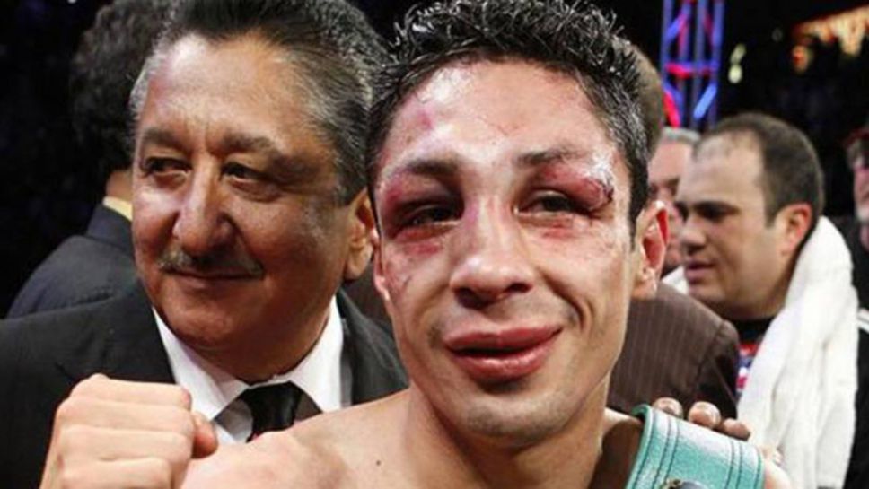 Боксов шампион губи едното си око