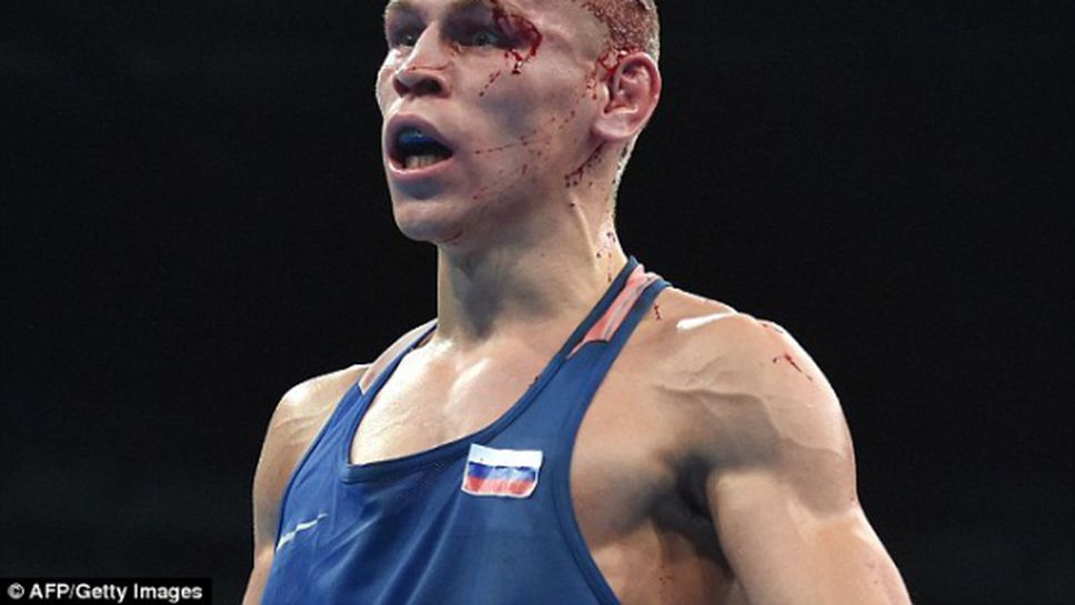 Скандалният боксьор Никитин се отказа заради раните
