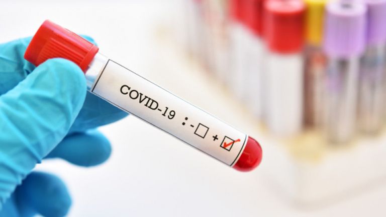 9 положителни проби за COVID-19 в Добруджа, проверката с Черно море пропадна