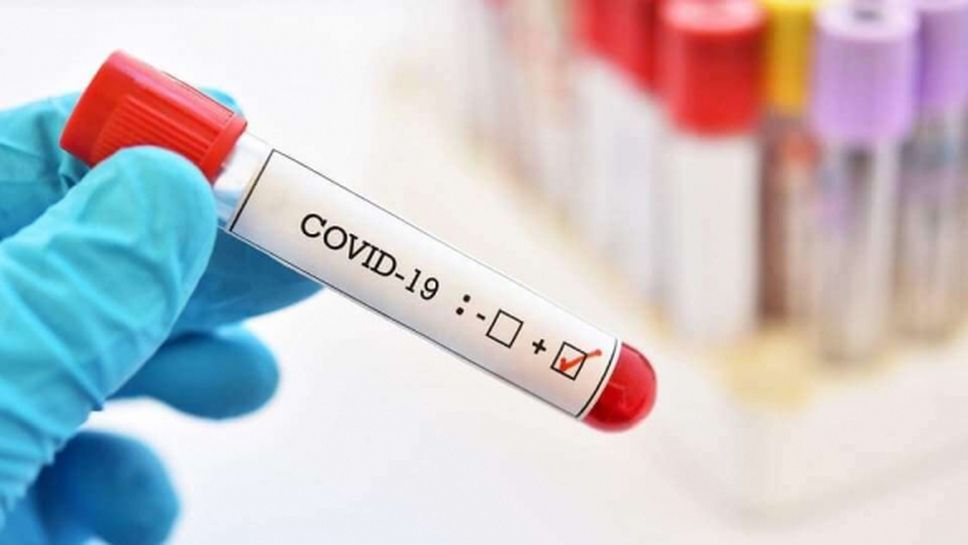 10 положителни теста за коронавирус в Премиър лийг до момента