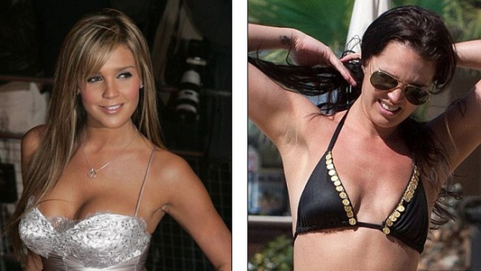 Даниел Лойд обвинява пластичните хирурзи за развода си с Джейми О'Хара