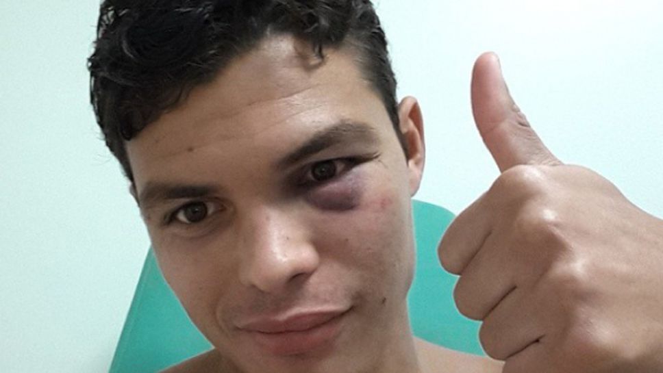 Тиаго Силва показа щетите от удара на Бербатов