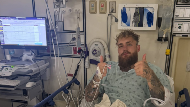 "Цяла седмица на течности и без няколко зъба", последствията от битка с Джошуа