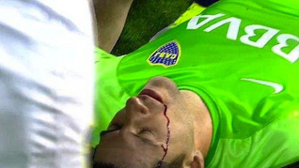 Страхотно пирошоу и ранен вратар на мач в Аржентина (видео)