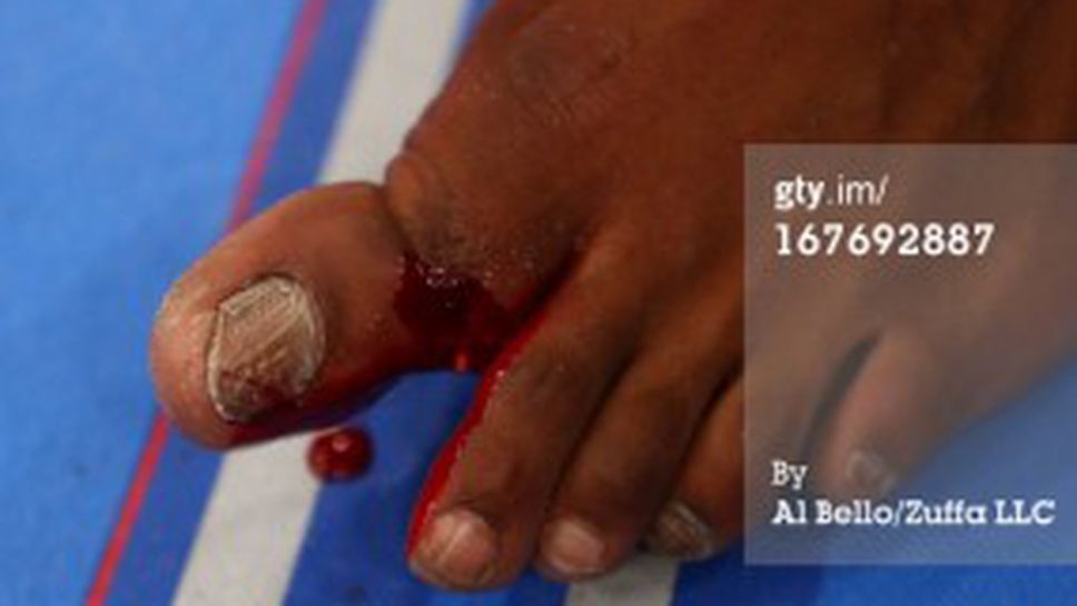 Джон Джоунс: Не разбрах, че съм счупил пръст