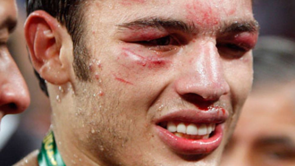 Чавес се контузи, отлагат мача с Вера