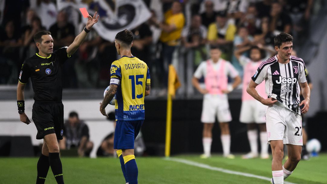 Ювентус остана без Камбиазо за дербито с Интер