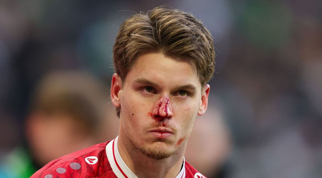 Защитник на Щутгарт ще играе със счупен нос срещу Йънг Бойс