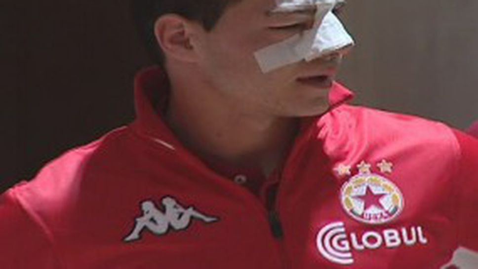 Счупиха носа на вратар в ЦСКА, сега е като Рамбо (видео)