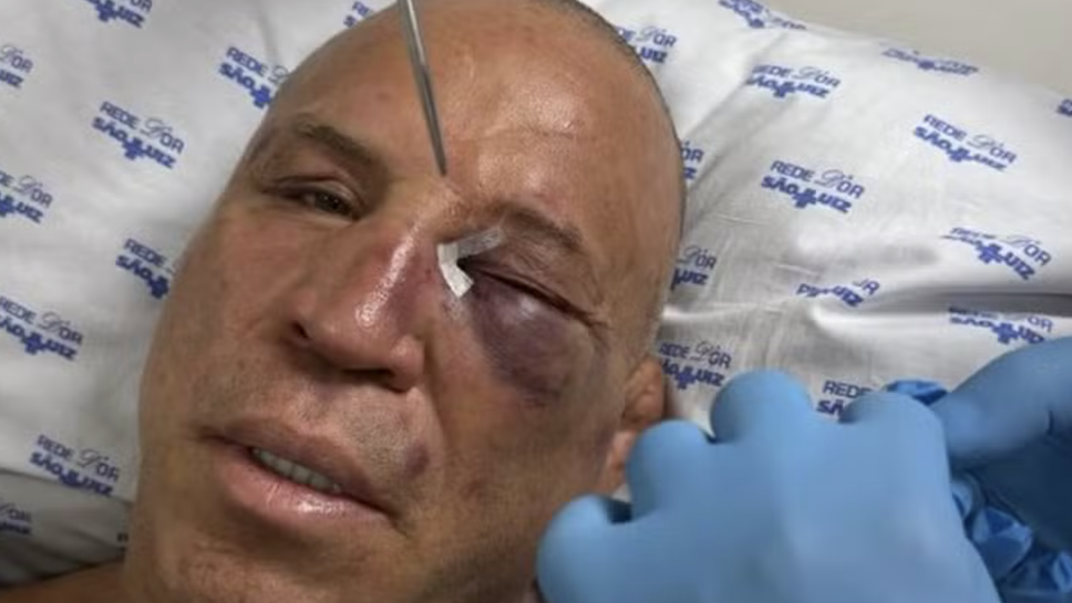 Станаха ясни повече подробности около нокаута нa Вандерлей Силва