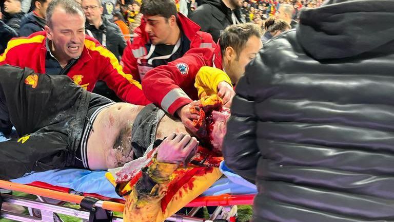 Фенове пострадаха след безредици по трибуните на мач в Турция