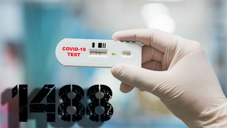 51 нови регистрирани случаи на коронавирус у нас