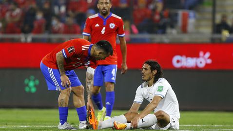  Нова контузия вади Кавани от игра 