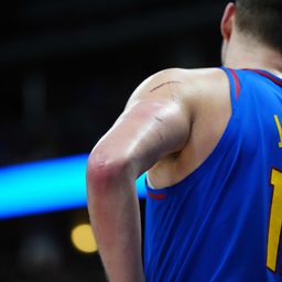 Jokić ponovo završio meč u jezivim ožiljcima: Neverovatno šta rade Srbinu u NBA ligi /VIDEO/