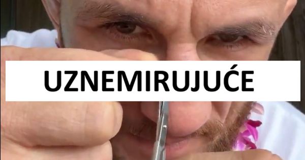 Nije za one sa slabim stomakom: UFC borac skidao sam sebi konce sa lica, sve prenosio uživo! /VIDEO/