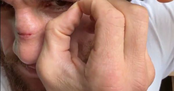 UFC borac sam sebi vadio konce makazama! /GALERIJA/