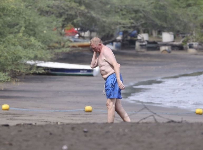 Beker na plaži šokirao svet ogromnim izraslinama na telu, svi su gledali u njegove ruke!