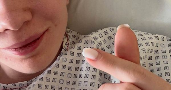 Poljakinja objavila prve fotografije nakon jezive povrede: Klizaljka joj prešla preko lica, umalo ostala bez oka! /FOTO/