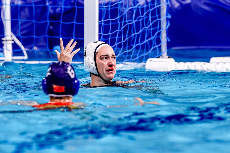 Ki hitte volna? Rengeteg a térdsérülés a vízilabdázóknál