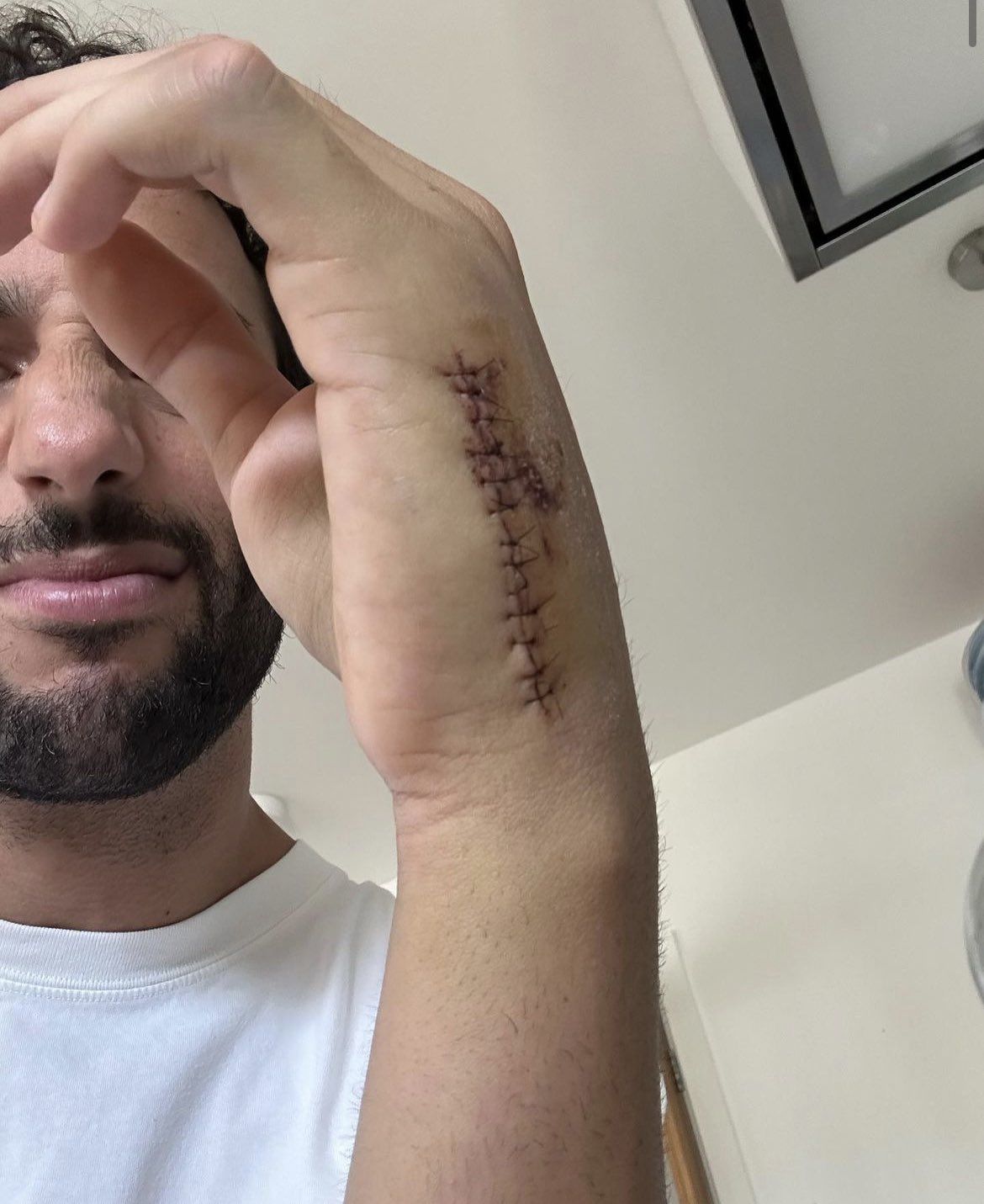 A megműtött bal csukló... (Fotó: Daniel Ricciardo/Instagram)