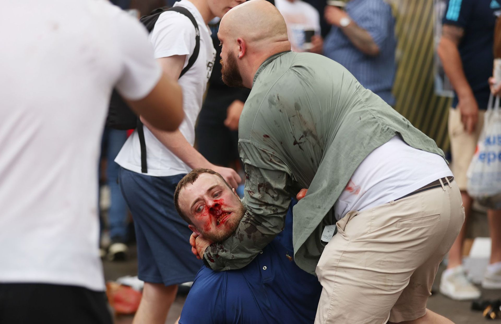 Az angolok több olasz szurkolót véresre vertek /Fotó: Getty Images