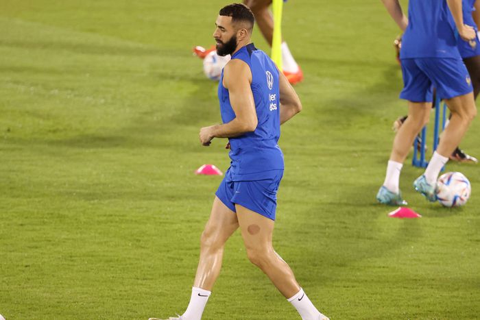 Karim Benzema lemarad a világbajnokságról