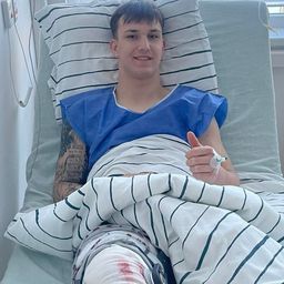 Czérna Erik a Debrecen elleni bajnoki hosszabbításában szenvedett sérülést. (Fotó: kisvardafc.hu)