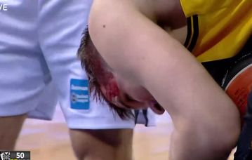 Στα αποδυτήρια με αίματα ο Αγραβάνης (vid)