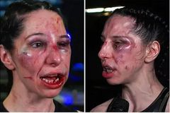 Μελανιασμένη, με βουλωμένα μάτια και σπασμένα δόντια δήλωσε: «Το απόλαυσα»