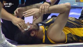 Μάτωσε στο φρύδι ο Κατσίβελης κατά τη διάρκεια του Κολοσσός - ΑΕΚ (vid)