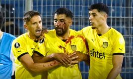 Σκληρές εικόνες: Παίκτης της Πενιαρόλ δέχθηκε πέτρα στο πρόσωπο από οπαδούς της Ροζάριο Σέντραλ (vids)