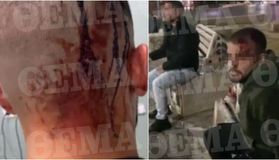 Αγρια επίθεση στη Νέα Φιλαδέλφεια σε δύο αδέρφια, τους χτύπησαν με ρόπαλα και τους μαχαίρωσαν