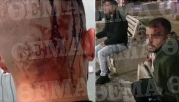 Αγρια επίθεση στη Νέα Φιλαδέλφεια σε δύο αδέρφια, τους χτύπησαν με ρόπαλα και τους μαχαίρωσαν