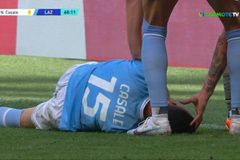 Ανατριχιαστικός τραυματισμός στο Μίλαν - Λάτσιο: O Καζάλε δέχθηκε κλωτσιά στο πρόσωπο (vid)