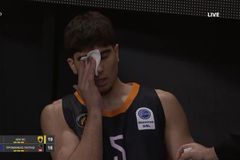 ΑΕΚ - Προμηθέας: Η φάση που μάτωσε στο πρόσωπο ο Πλώτας