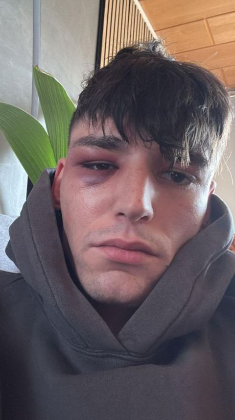 Θύμα βίαιης επίθεσης έπεσε ο διαιτητής που έκανε πρόταση γάμου στον σύντροφό του στο γήπεδο