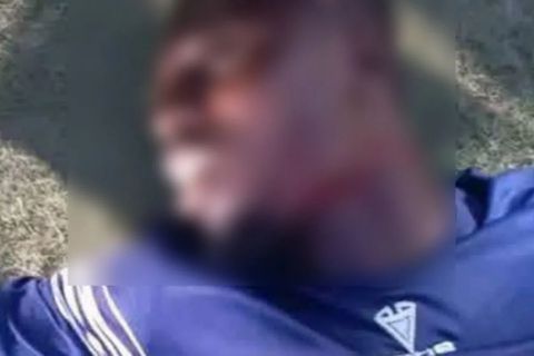 Σοκαριστική επίθεση σε ποδοσφαιριστή στη Νιγηρία: Οπαδός του έκοψε τον λαιμό