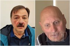 Τα σημάδια του Δημοτικού Συμβούλου που δέχτηκε επίθεση και έκανε μήνυση στον Μπέο - Ποιος τον χτύπησε και τι δηλώνει (vid)