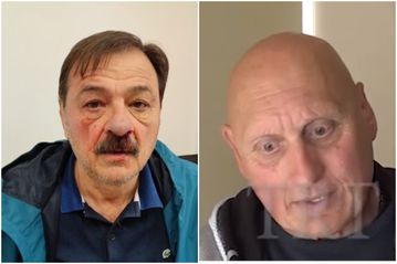 Τα σημάδια του Δημοτικού Συμβούλου που δέχτηκε επίθεση και έκανε μήνυση στον Μπέο - Ποιος τον χτύπησε και τι δηλώνει (vid)