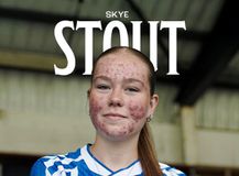 Απίστευτο: Η Κιλμάρνοκ απέσυρε ανάρτηση ανακοίνωσης παίκτριάς της επειδή δέχθηκε διαδικτυακό bullying !