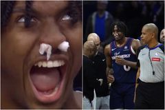 Ο Μάξεϊ χαμογελάει και διασκεδάζει ακόμα και με... σπασμένη μύτη (vids)