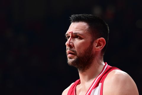 Ασύλληπτο - Ο Παπανικολάου δέχτηκε αγκωνιά, μάτωσε και χρεώθηκε με φάουλ! (pic)