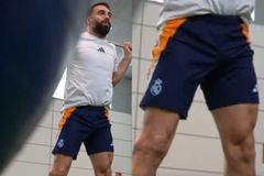 Η εικόνα του ποδιού του Καρβαχάλ που... σοκάρει, πέντε μήνες μετά την επέμβαση