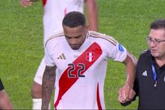 Ο Κάλενς τραυματίστηκε στην πρεμιέρα του Περού στο Κόπα Αμέρικα κι έγινε αναγκαστική αλλαγή