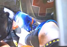 Ανατριχιαστική στιγμή: Οι γιατροί του Άρη αναγκάστηκαν να κόψουν την κάλτσα του Αλφαρελά