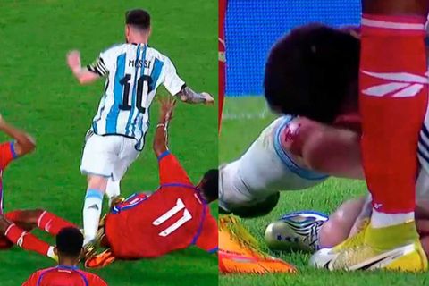 Τρομακτικό μαρκάρισμα από δύο παίκτες στον Μέσι: Μάτωσε το γόνατο του Αργεντινού (vids)