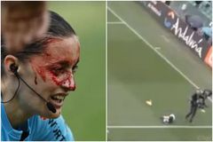 Σοκ: Βρέθηκε το βίντεο της σύγκρουσης της βοηθού με την τηλεοπτική κάμερα από την οποία κατέληξε στο νοσοκομείο!