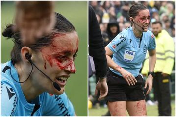 Σοκαριστικό σκηνικό: Η βοηθός του Μπέτις – Μπιλμπάο αποχώρησε αιμόφυρτη μετά τη σύγκρουσή της με την κάμερα της μετάδοσης!