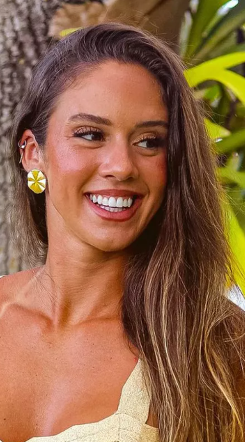 «Ξεγέλασε» τον θάνατο: Βραζιλιάνα βολεϊμπολίστρια επέζησε μετά από σφαίρα που δέχθηκε στη διάρκεια ένοπλης ληστείας!