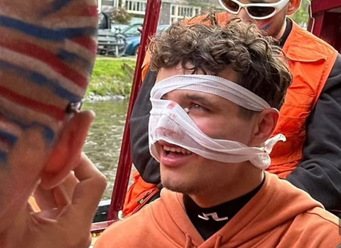 Ο Νόρις τραυματίστηκε σε πάρτι στην Ολλανδία (vids)